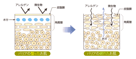 肌の状態イメージ